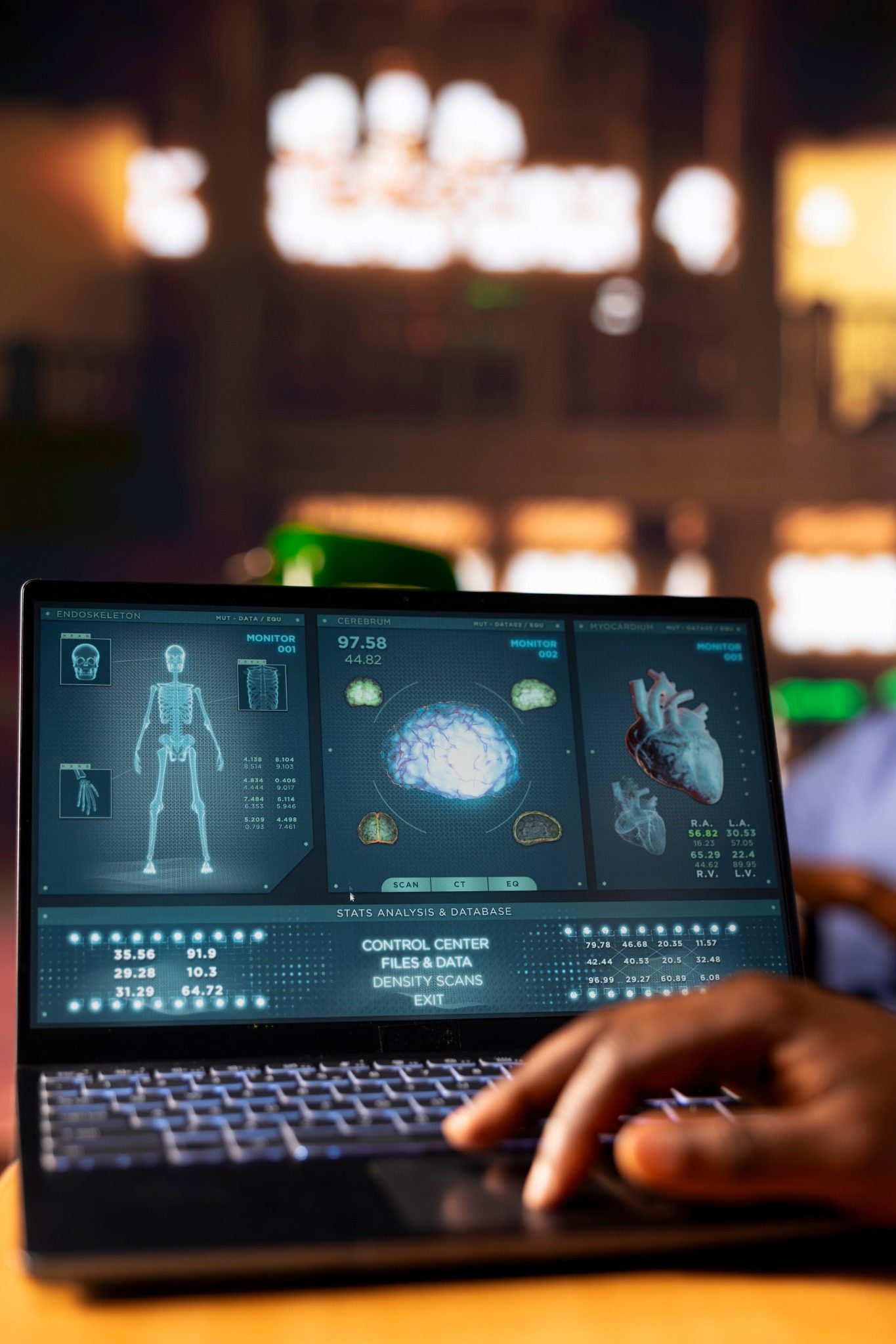 Healthcare intelligence dashboard on laptop
